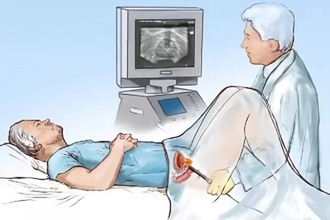 diagnosis of prostatitis